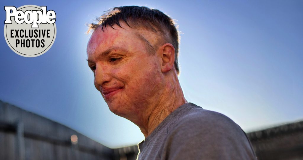 Telgian Expert Weighs in on Apartment Fire Safety Tips in People Magazine